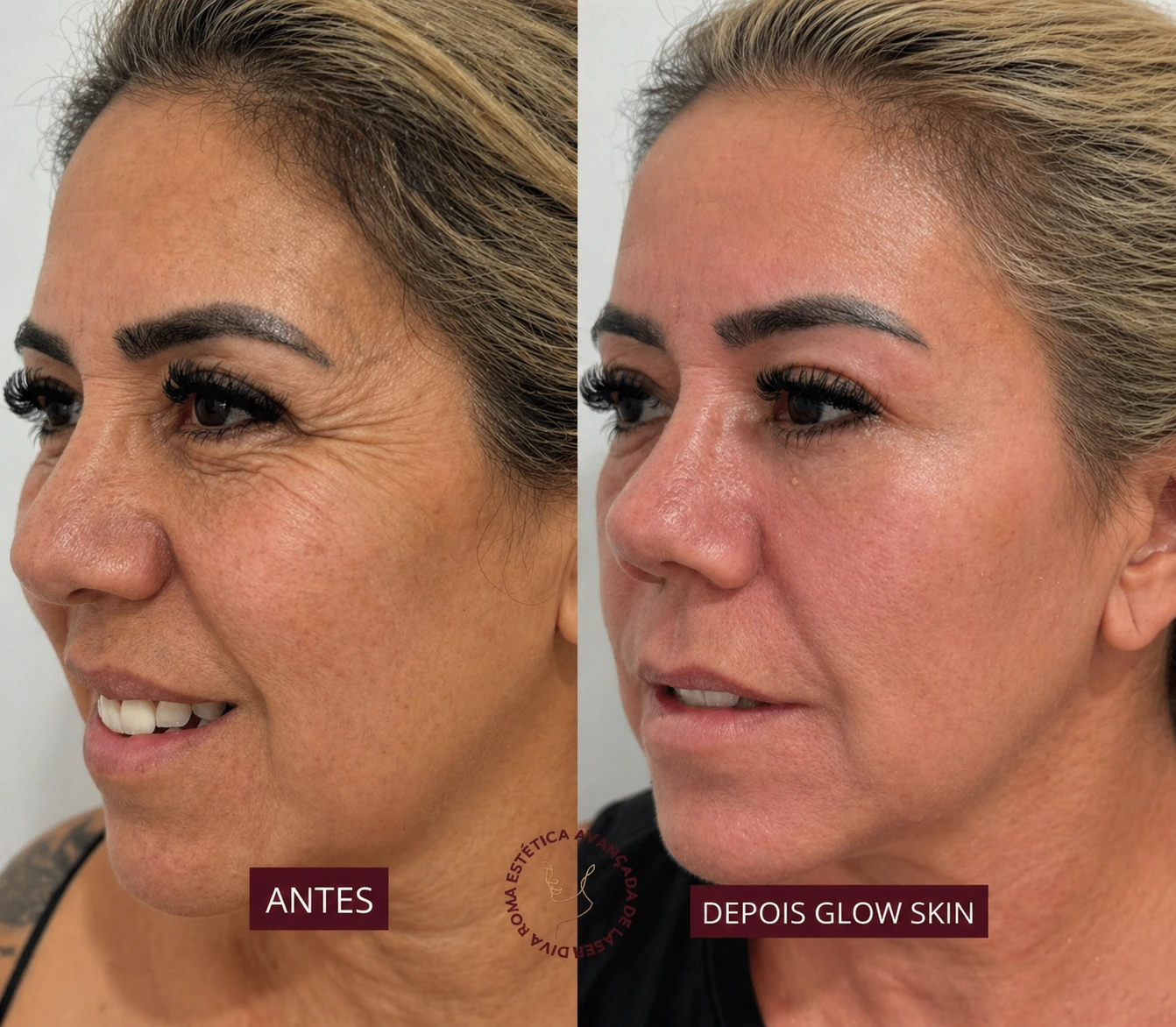 Resultado antes e depois 9
